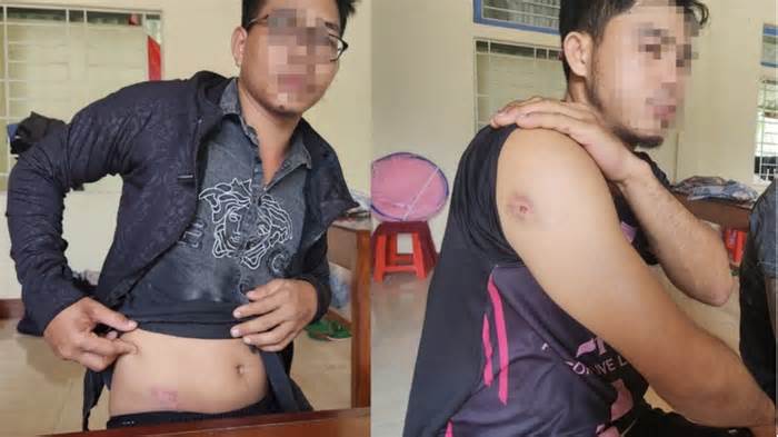 Ba người lái máy gặt thuê bị hành hung ở Quảng Trị