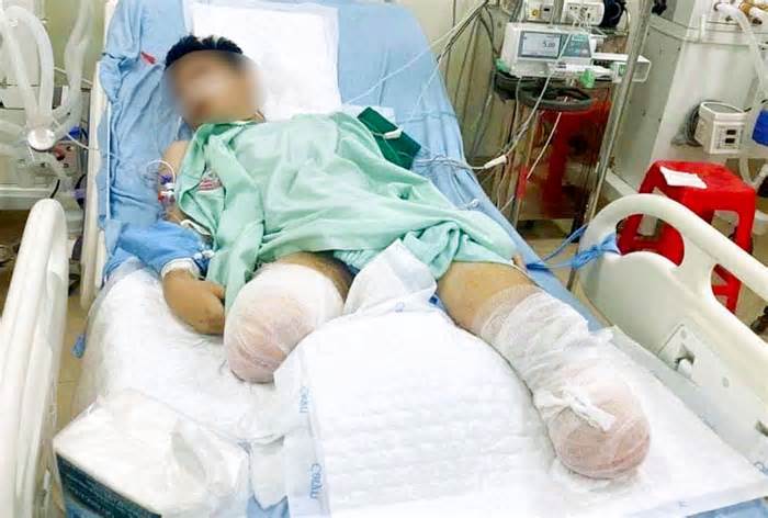 Xét đặc cách tốt nghiệp THPT cho nam sinh ở Vĩnh Phúc bị tai nạn mất đôi chân