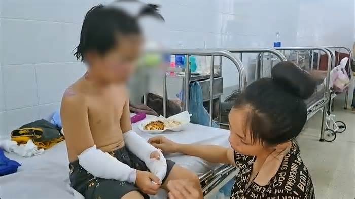 Vụ cháy nhà ở Tây Ninh: 4 bệnh nhi bỏng độ 2 đang tích cực điều trị