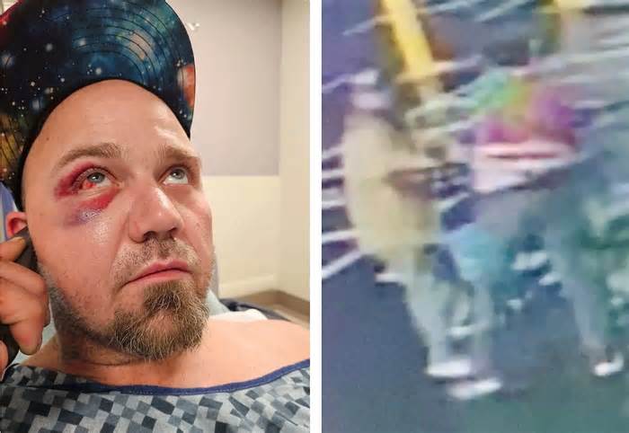 Kẻ trộm kiện ngược nhân viên siêu thị vì bị đuổi đánh