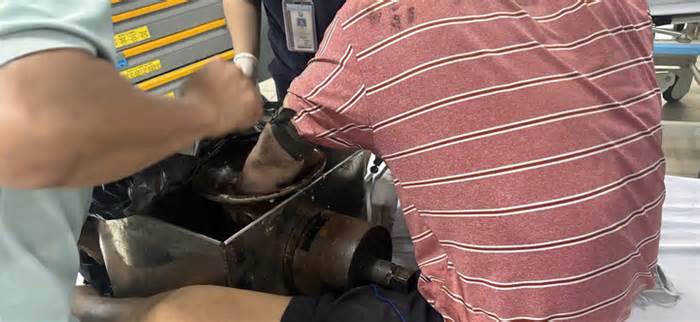 Người đàn ông nhập viện với bàn tay kẹt cứng trong máy xay thịt