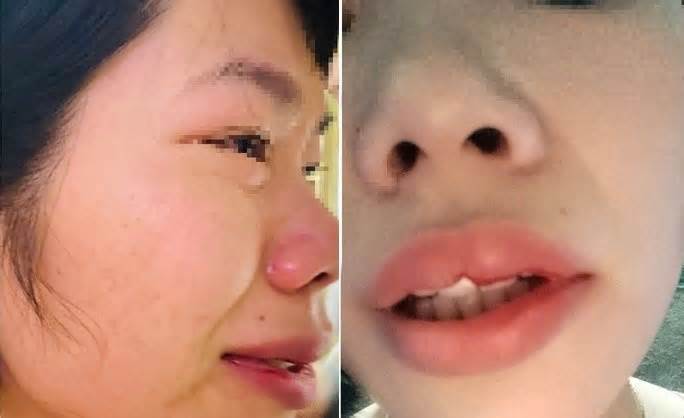 Đắk Nông chỉ đạo xử lý nghiêm vụ cô giáo bị hành hung