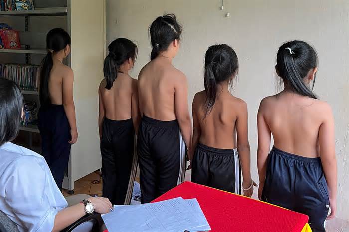 Hơn 1.000 học sinh Gia Lai bị cong vẹo cột sống