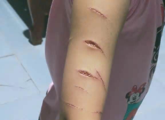 Công an thông tin vụ nữ sinh lớp 5 ở Cà Mau bị rạch tay