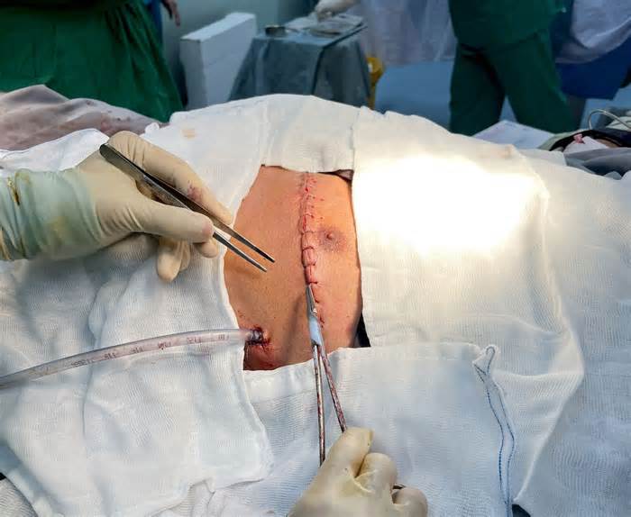 Gia cảnh khó khăn của bệnh nhân bị thanh kim loại đâm thủng tim