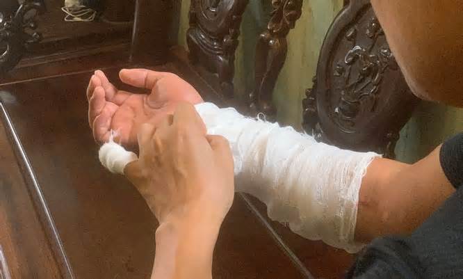 Hà Nội: Khởi tố vụ người đàn ông bị chém đứt lìa cánh tay