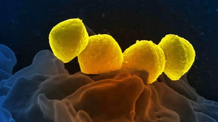 163 người chết do vi khuẩn hiếm gặp ở Nhật Bản, Thái Lan cảnh báo công dân