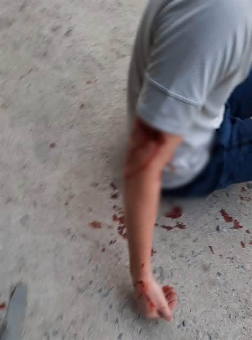Nha Trang: Xác minh việc du khách nước ngoài bị chó cắn rách tay