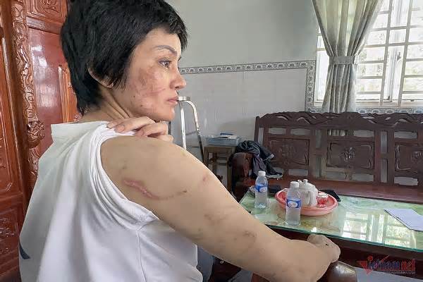 Hải Dương: Hội Phụ nữ vào cuộc vụ thai phụ ở Kiên Giang tố chồng bạo hành