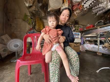 Vụ tai nạn khiến cháu bé mất đôi chân ở Gia Lai, huyện yêu cầu làm rõ