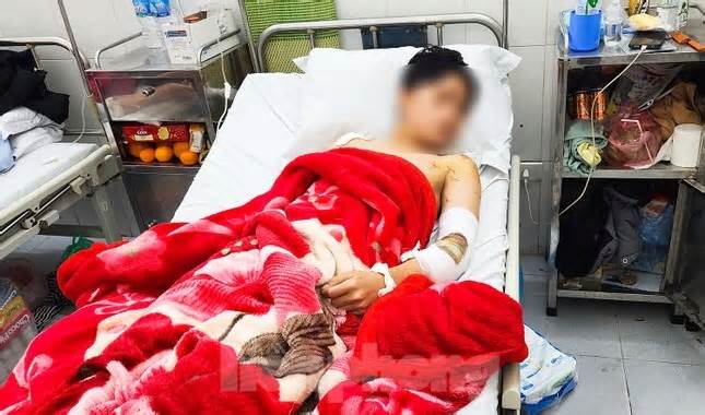 Nam sinh bị 2 con chó dữ tấn công ở Lào Cai sức khoẻ đang hồi phục