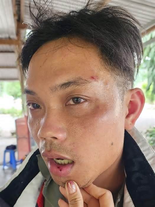 Xác minh việc nhân viên quán hải sản ở Khánh Hòa bị tố hành hung khách du lịch