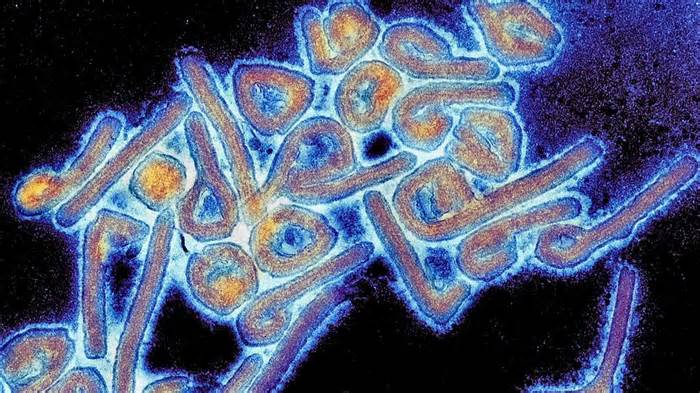 Loại virus gây tử vong cao bùng phát tại Rwanda