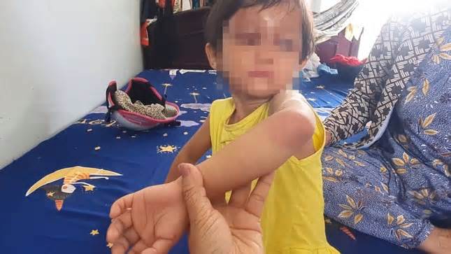 Làm rõ vụ bé gái 4 tuổi ở Cà Mau nghi bị cha nuôi đánh gây thương tích