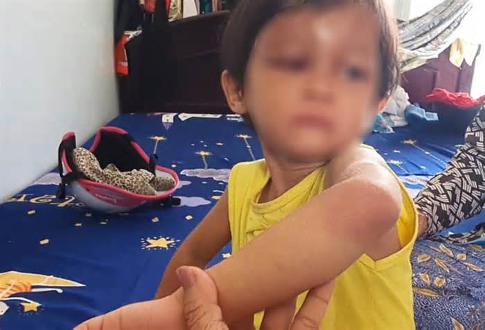 Bắt tạm giam cha nuôi bạo hành bé gái 4 tuổi ở Cà Mau