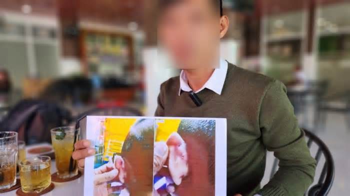 Khởi tố cô giáo mầm non đánh trẻ gây thương tích ở Kiên Giang