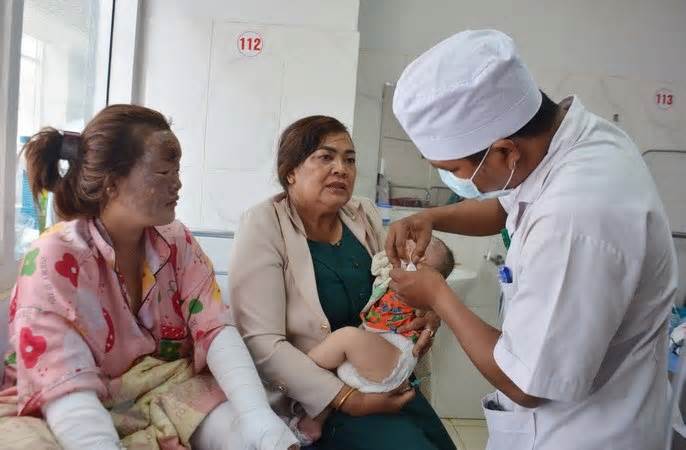 Vụ nổ bình gas mini ở Đắk Lắk: Tích cực điều trị cho các bệnh nhân