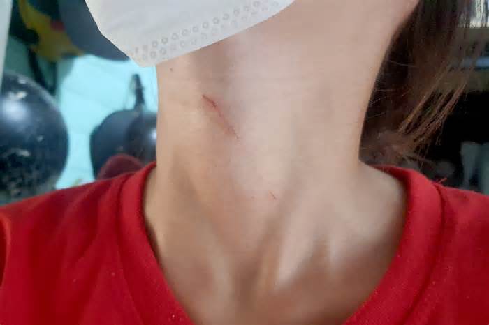 Kề dao vào cổ nữ nhân viên cướp bông tai trong nhà kho ở TPHCM