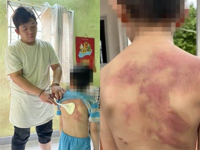 Cha bạo hành con ruột ở Đồng Nai: Dùng dây sạc, xẻng nấu ăn đánh con