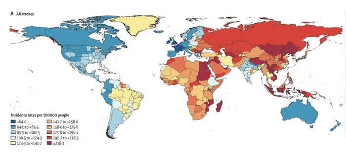 Vì sao tỷ lệ đột quỵ Việt Nam dẫn đầu thế giới?