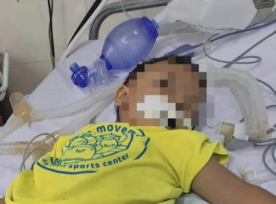Từ trường về nhà, bé trai 3 tuổi ở Khánh Hòa bị xuất huyết não nguy kịch