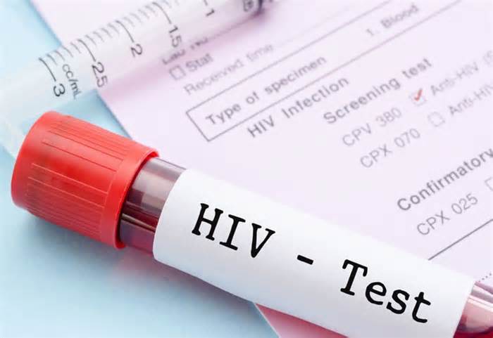 Điều kiện xác định người bị nhiễm HIV do tai nạn rủi ro nghề nghiệp