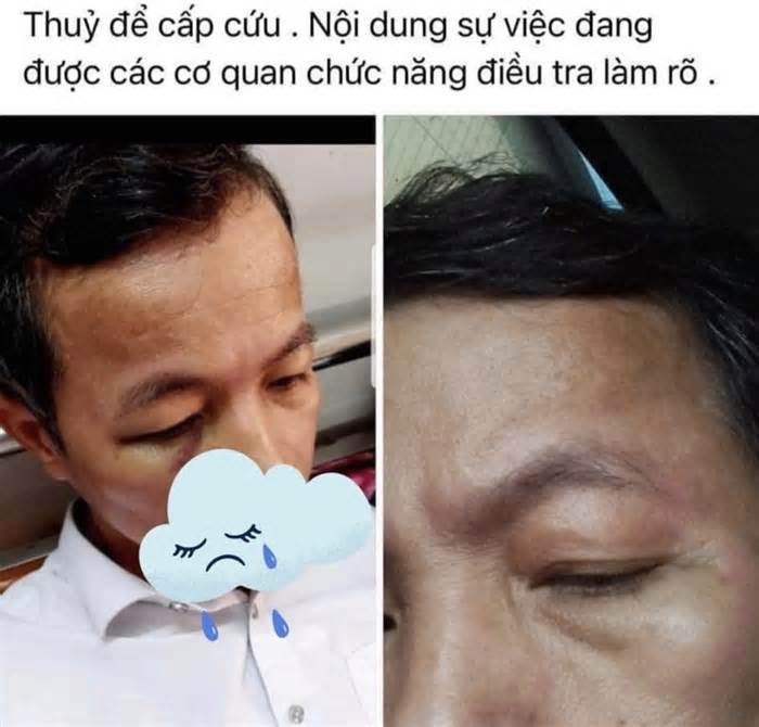 Hiệu trưởng đấm hiệu phó nhập viện, làm sao dạy học trò?