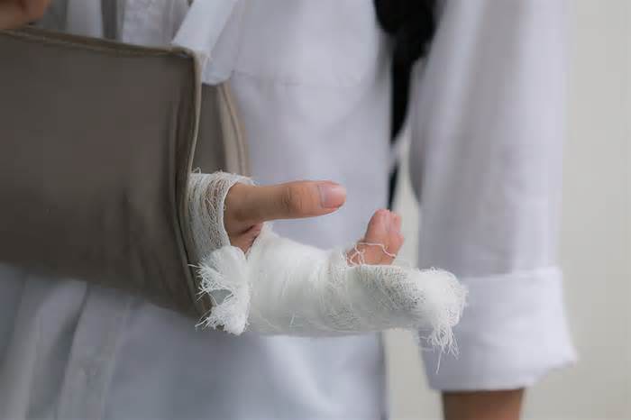 Nam sinh Hà Nội gãy ngón tay, tự tháo bột trước hạn để thi tốt nghiệp THPT