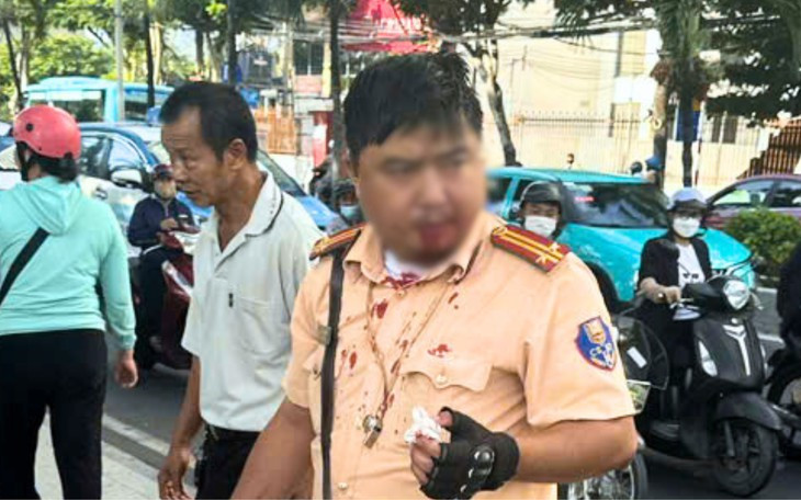 Trung tá Giang bị đấm chảy máu miệng. Ảnh: P.A.