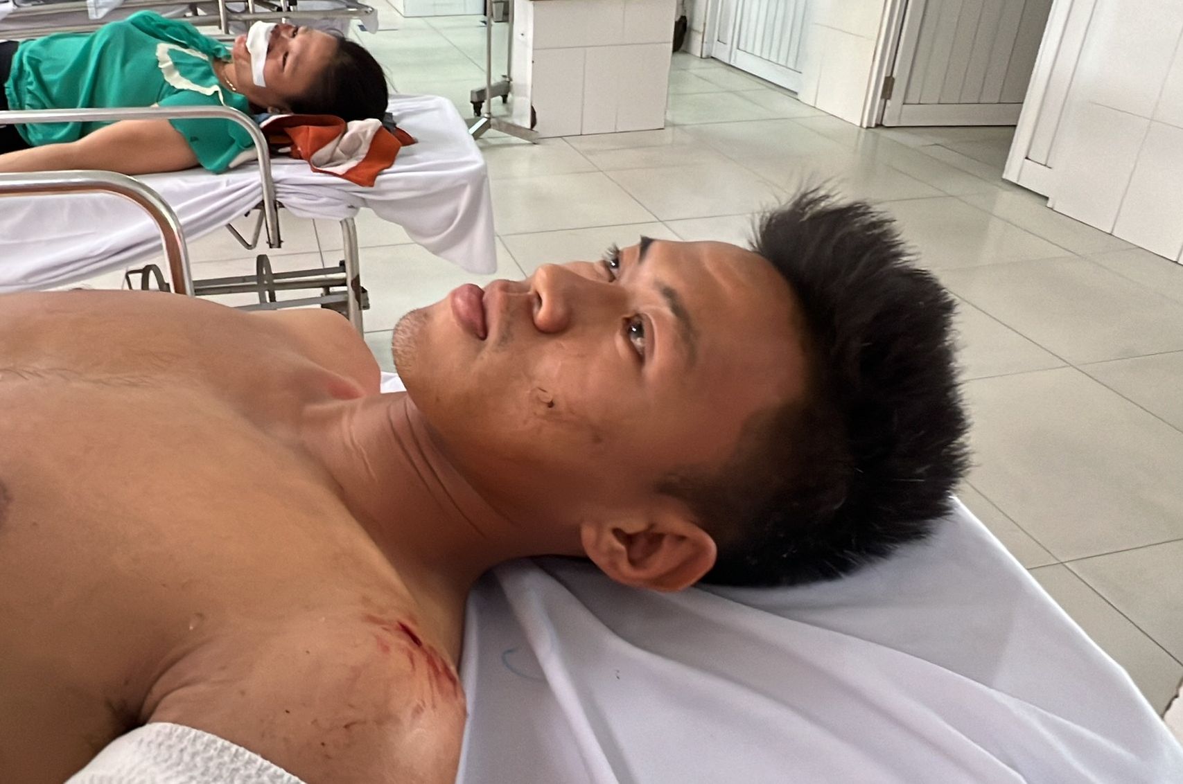 Nạn nhân bàng hoàng kể lại phút xe chở CLB bóng đá trẻ Quảng Nam lật khiến 3 người thương vong