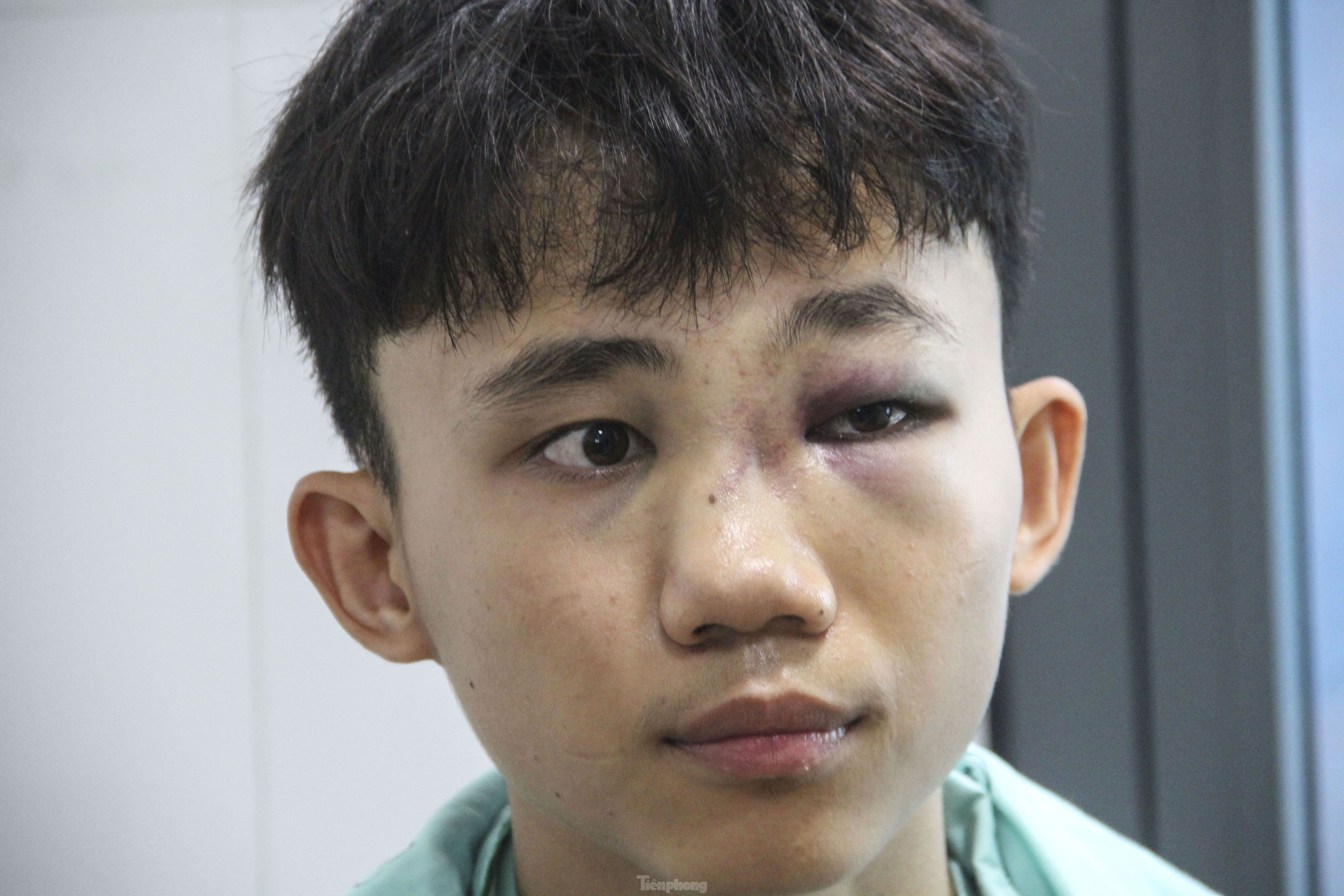 Bình Định: Học sinh lớp 10 bị đánh hội đồng nhập viện