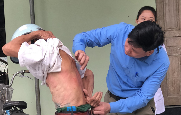 Hàng loạt người dân ở Thanh Hóa bị ngứa ngoài da kéo dài chưa rõ nguyên nhân