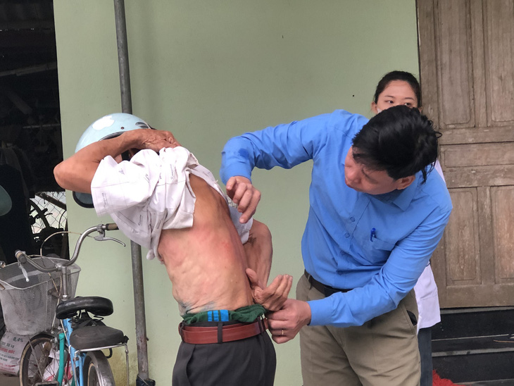 Hàng loạt người dân ở Thanh Hóa bị ngứa ngoài da do ký sinh trùng